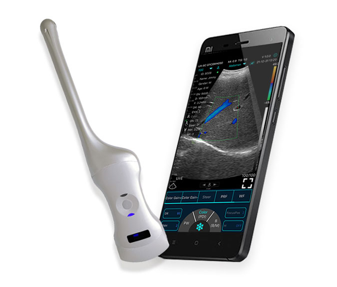 mobile ultrasound machine
