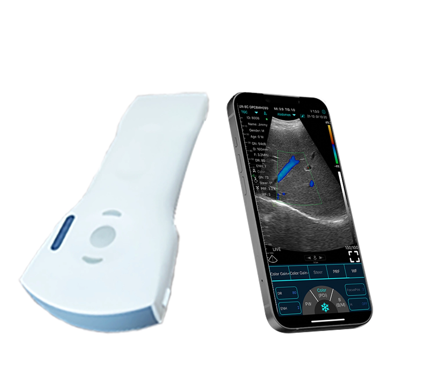 c10cx handheld ultrasound
