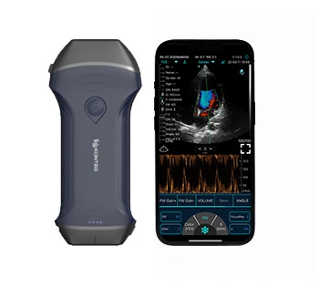 xl pro ultrasound device 1