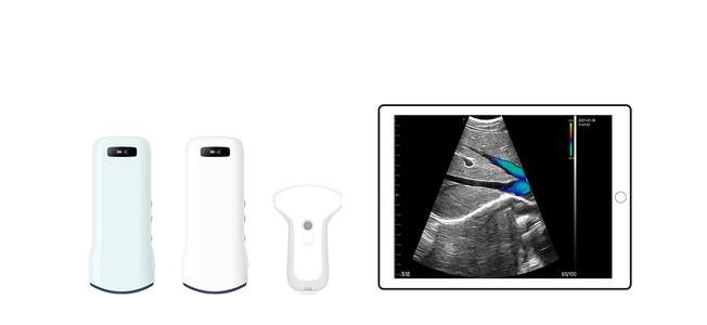 Ultrasound Examination Methods for Abdominal Area
