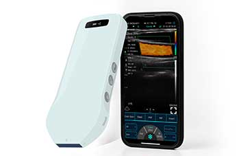 Wireless Ultrasound Can Become Doctors' Assistant Like Stethoscopes
