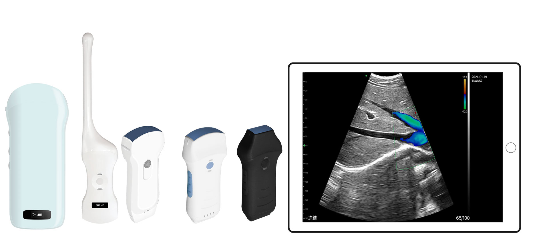 Preparation Work Before B-Mode Ultrasound Examination