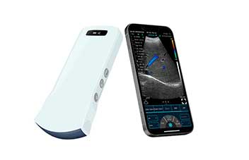 Handheld Smartphone Ultrasound Probe for Comfortable and Easy Grip