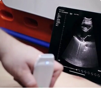 Wireless Ultrasound Probe Used in Cardiology