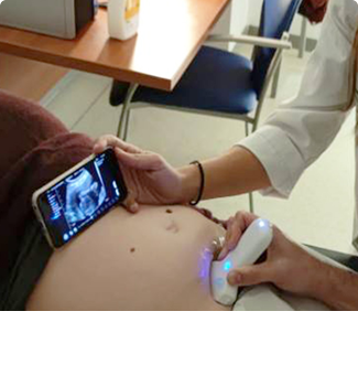 Wireless Ultrasound Probe Used in OB&GYN