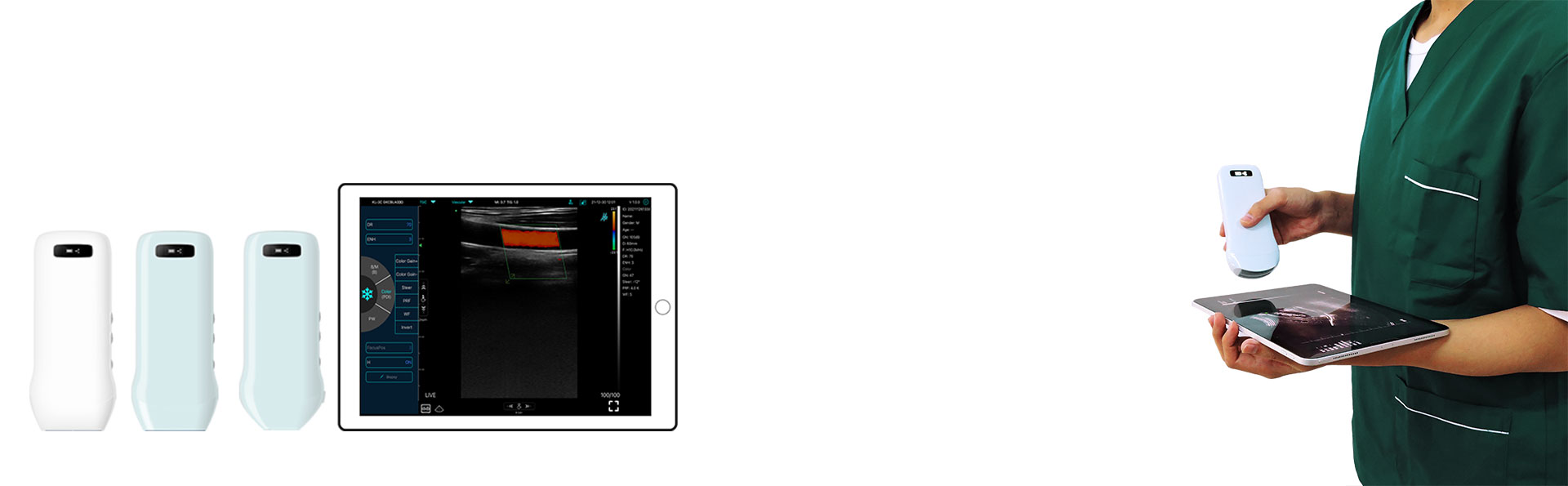 Color Superfical Ultrasound