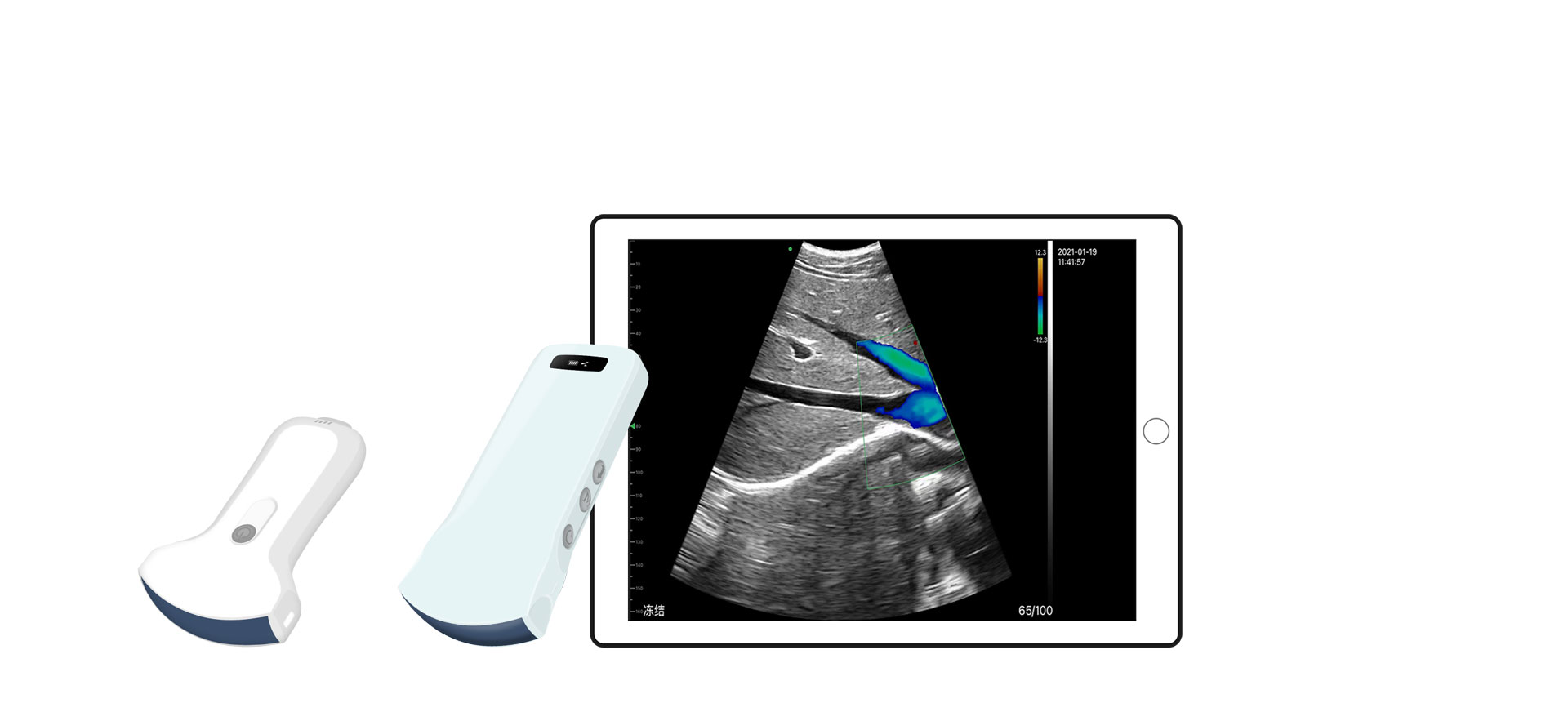 Color Abdomen Ultrasound