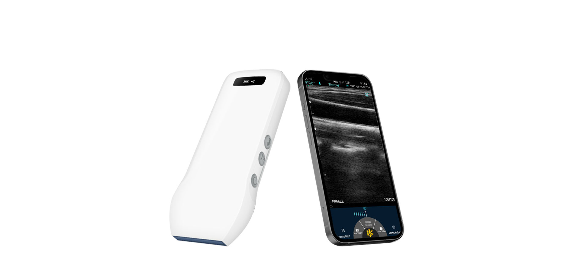 B&W Superfical Ultrasound