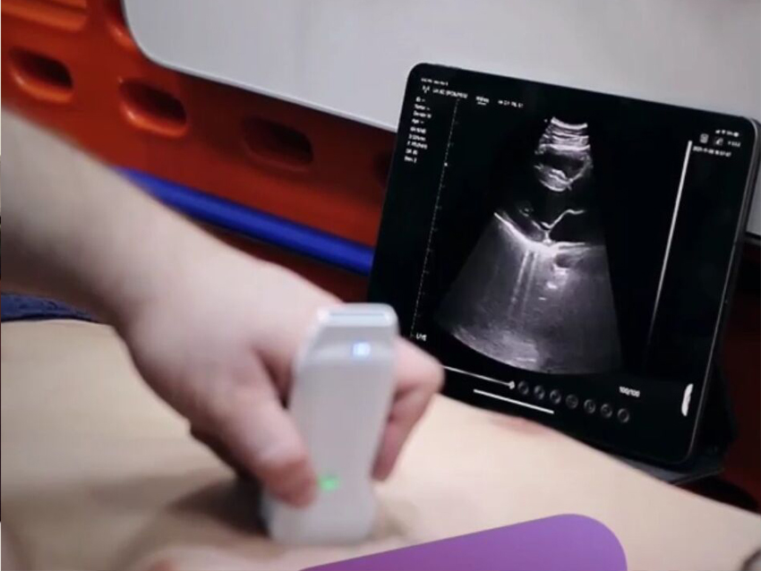 Wireless Ultrasound Probe Used in Cardiology