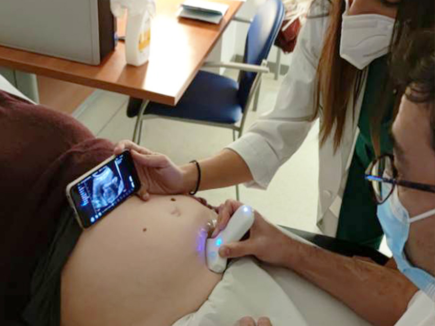 handheld ultrasound device used in ob gyn