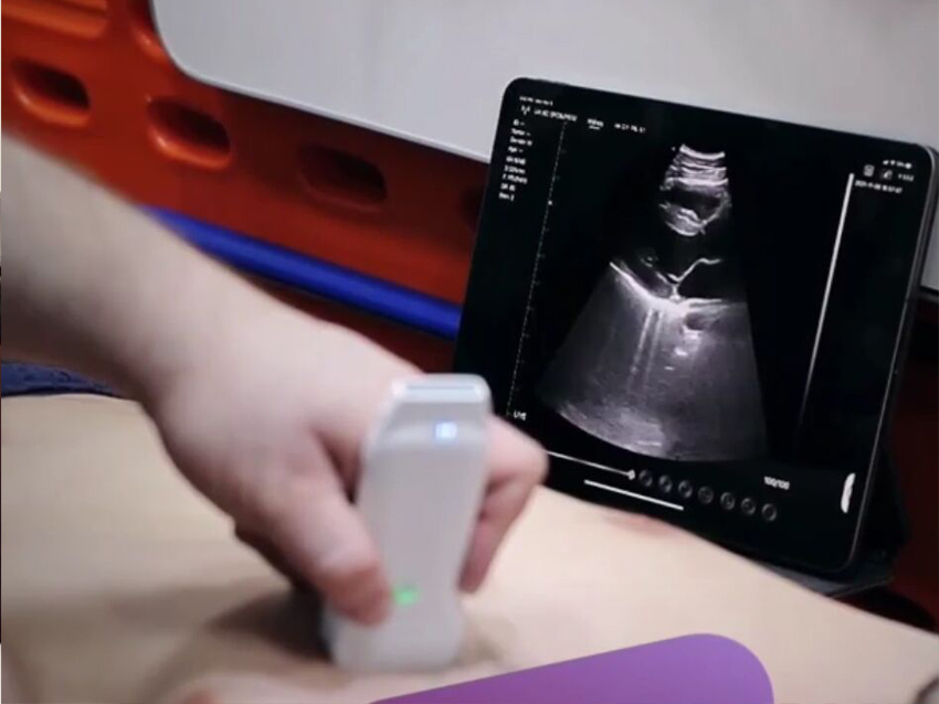 wireless ultrasound probe used in cardiology