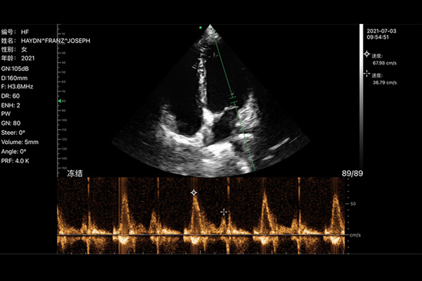 handheld ultrasound machine cost