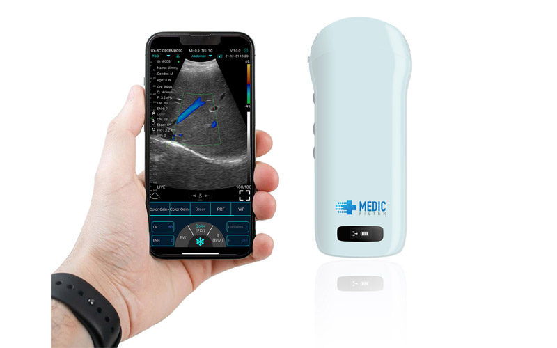 abdominal probe ultrasound