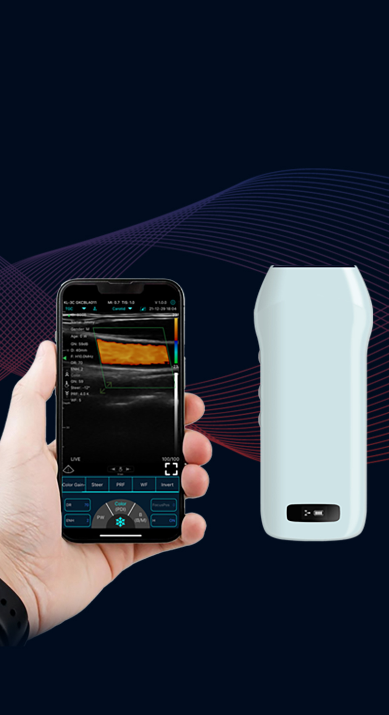 START YOUR HANDHELD ULTRASOUND, EASY TO USE, ANYTIME, ANYWHERE