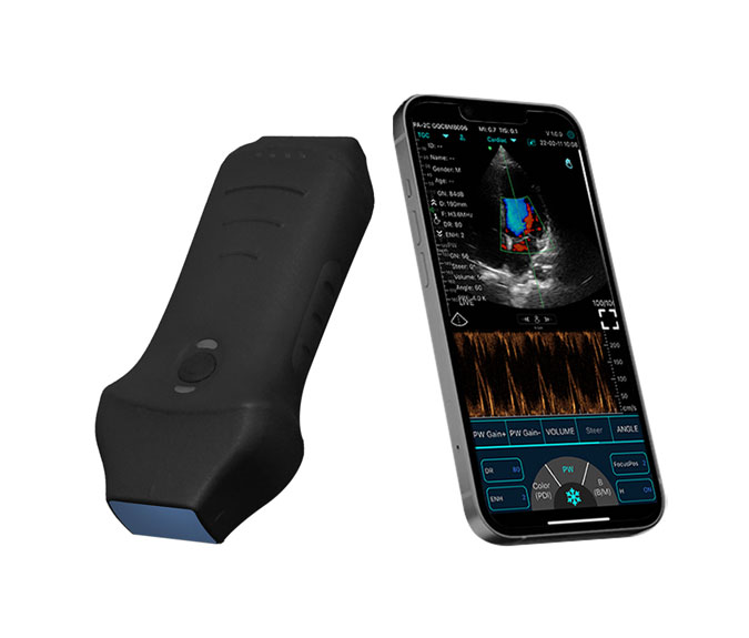 bluetooth ultrasound device