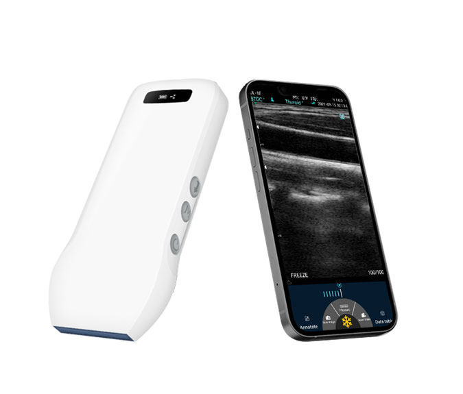 curved linear ultrasound probe