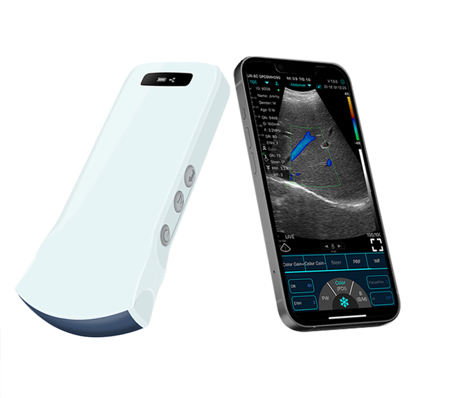 curved probe ultrasound