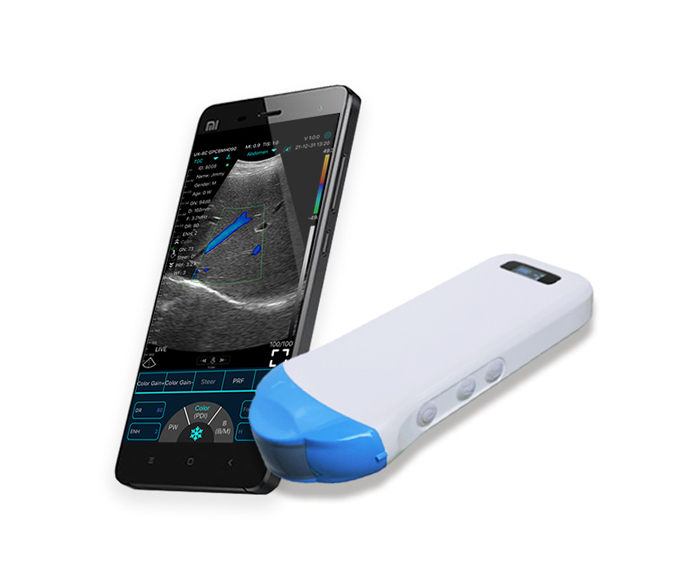 handheld portable ultrasound
