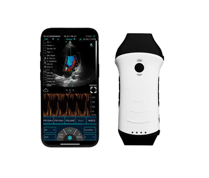 handheld wireless ultrasound