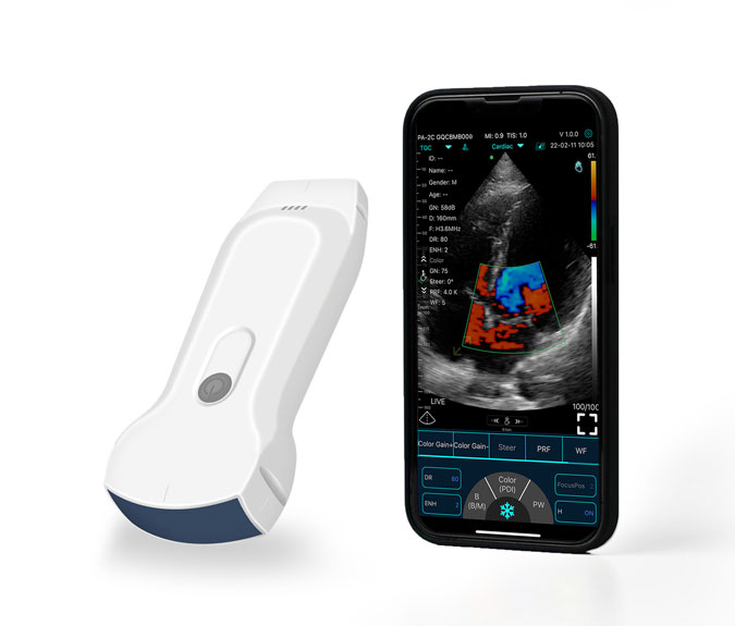 Konted C10RL mobile ultrasound device