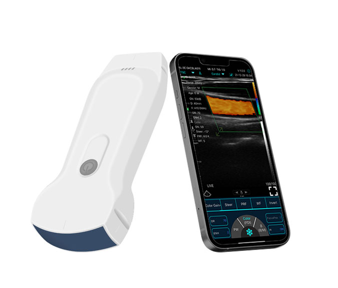 Konted C10RL mobile ultrasound equipment