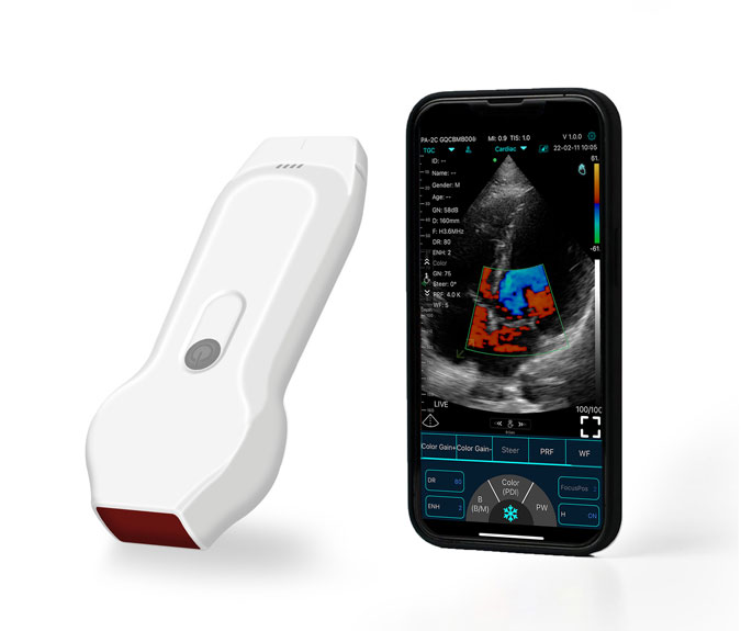 pocket ultrasound device