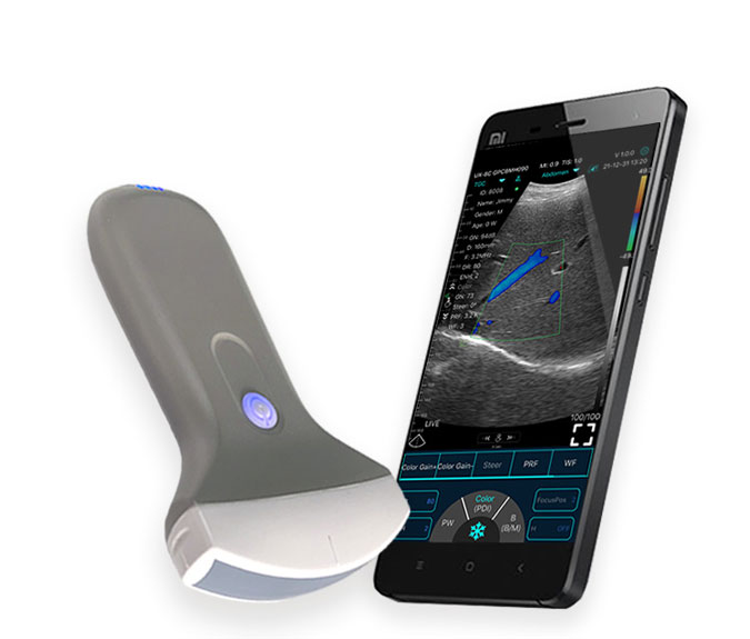 ultrasound convex probe