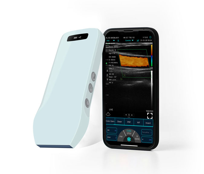 ultrasound probe linear