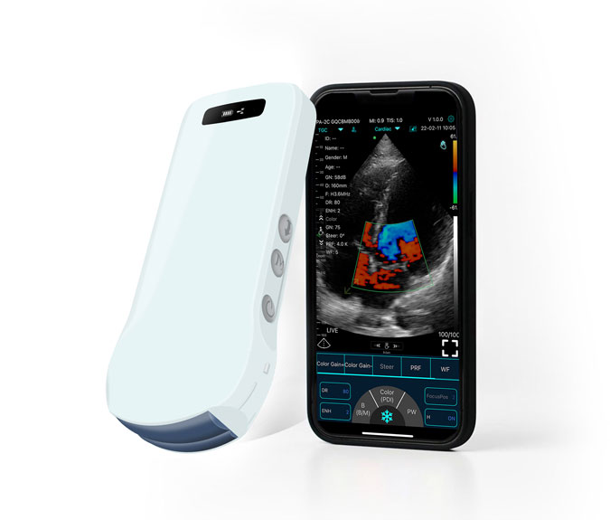 whole body ultrasound scan