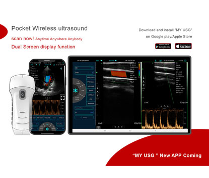 Features of C10UC cardiac wireless probe