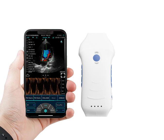 handheld wireless ultrasound probe 1