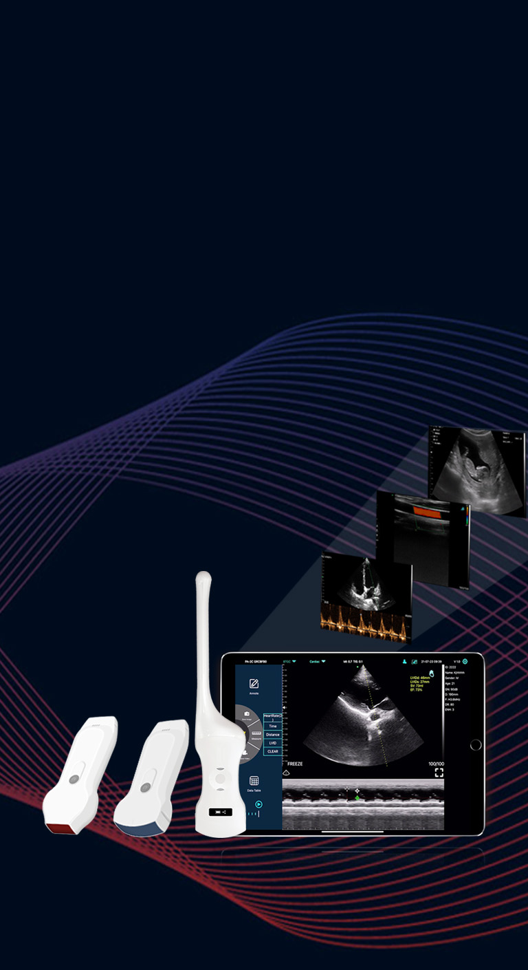 Dual head wireless ultrasound probe