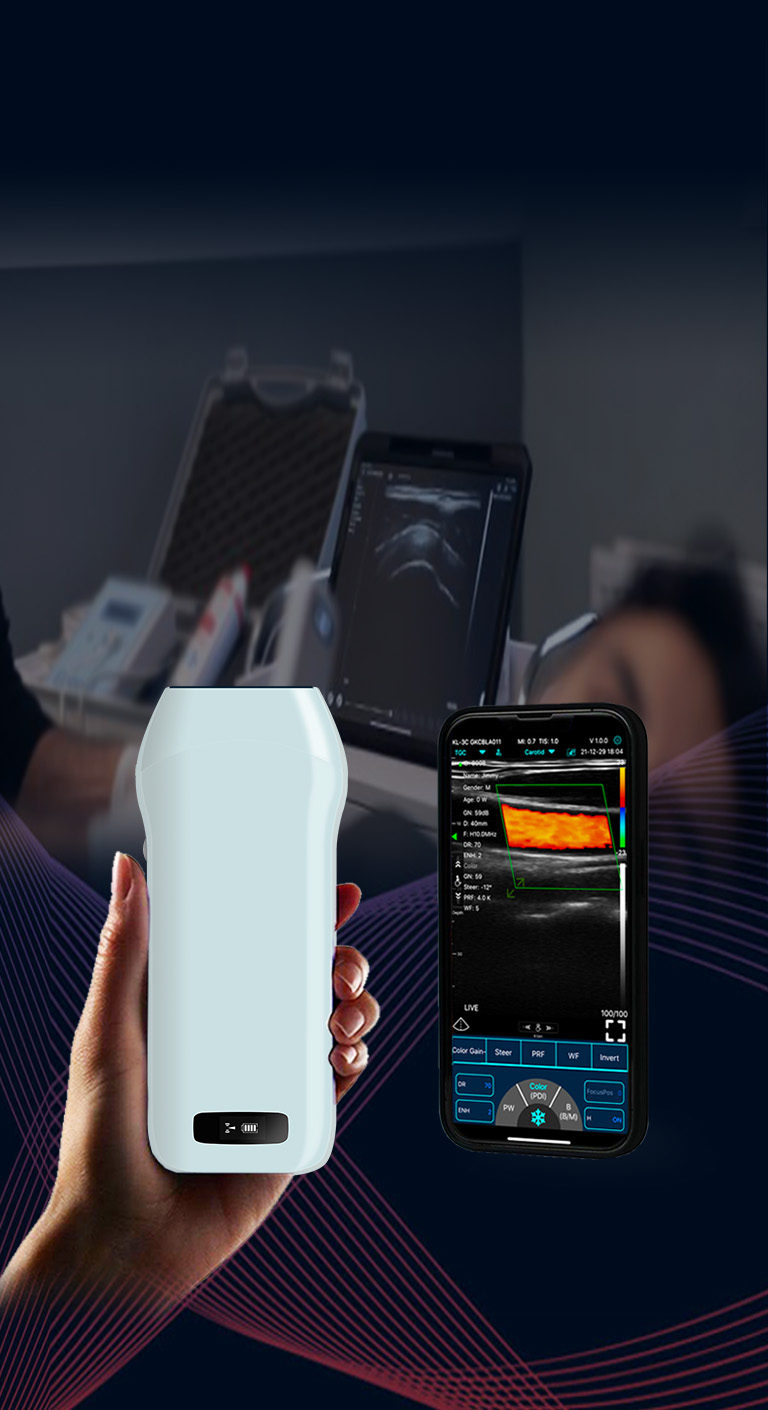START YOUR HANDHELD ULTRASOUND, EASY TO USE, ANYTIME, ANYWHERE