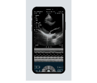 Features of C10XL Dual-probes Multipurpose Ultrasound linear+phased probe