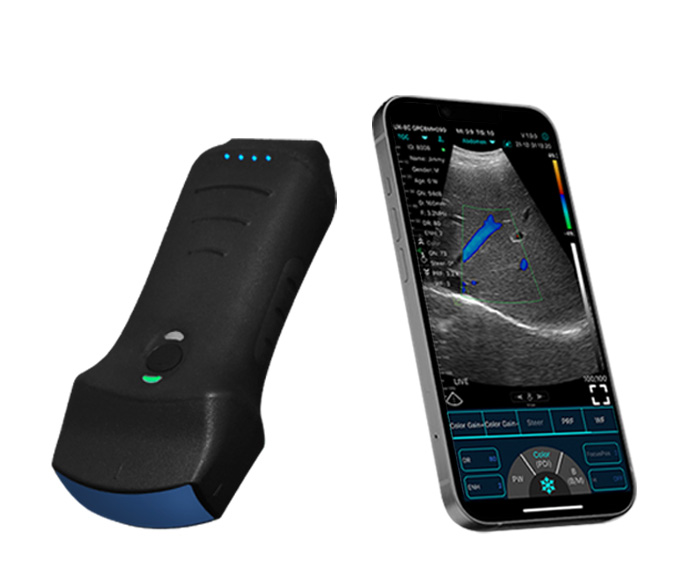 bluetooth-ultrasound.jpg