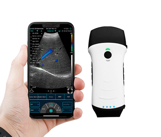 pocket-ultrasound-machine.jpg