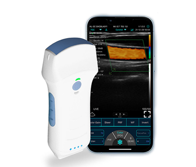 portable handheld ultrasound scanner