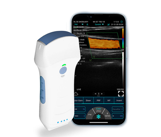 portable-handheld-ultrasound-scanner.jpg
