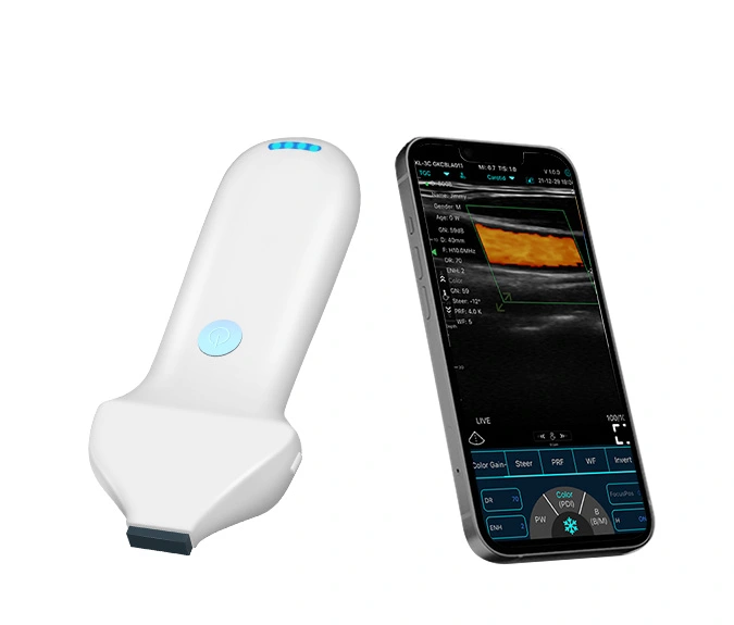 wireless high linear ultrasound2