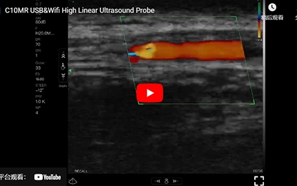 C10MR USB&Wifi High Linear Ultrasound Probe Demo