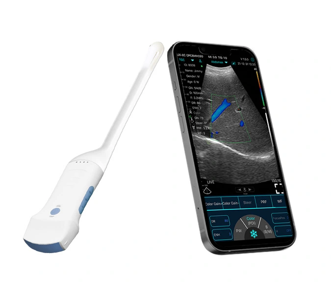 c10rc dualhead handheld ultrasound