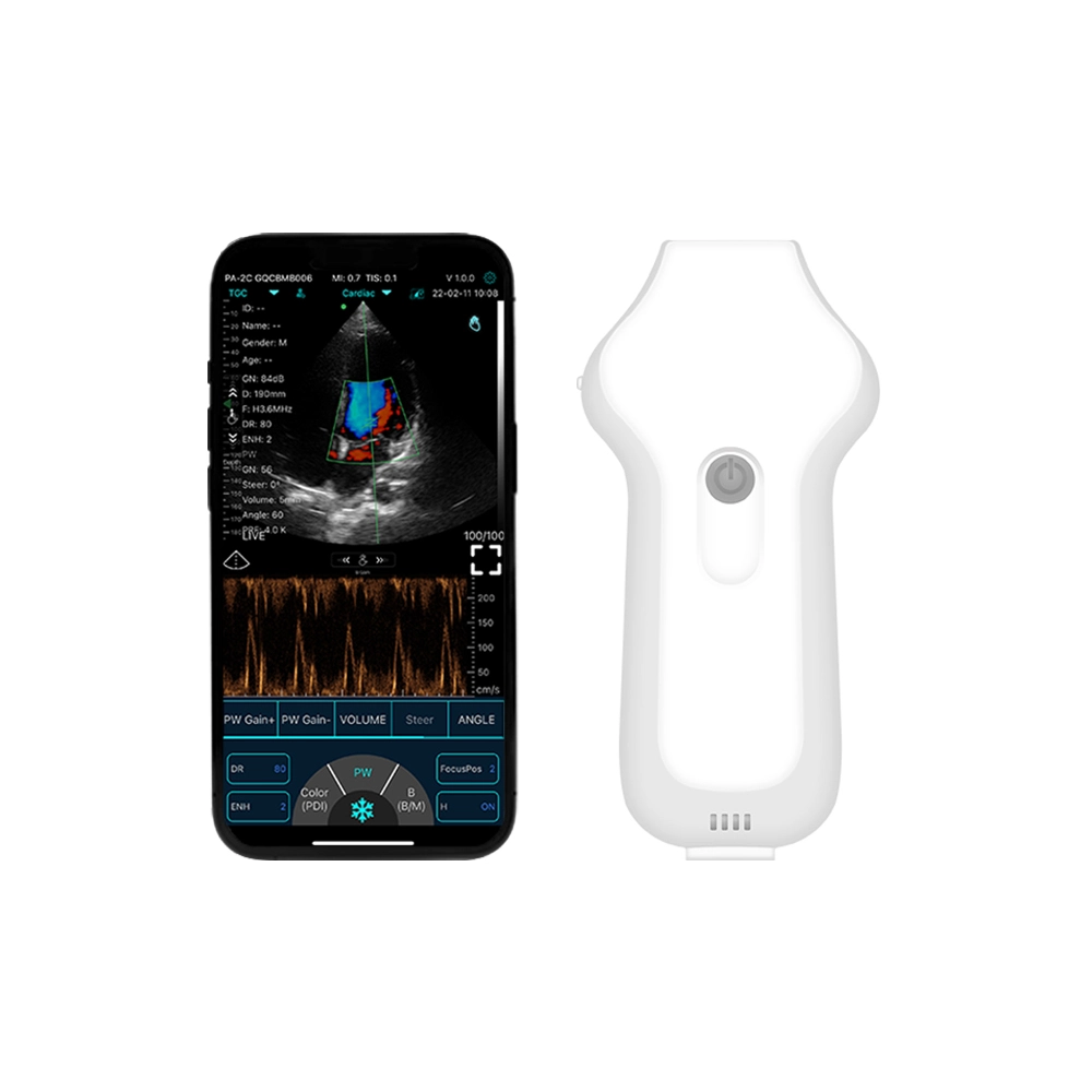wireless c10cs handheld ultrasound