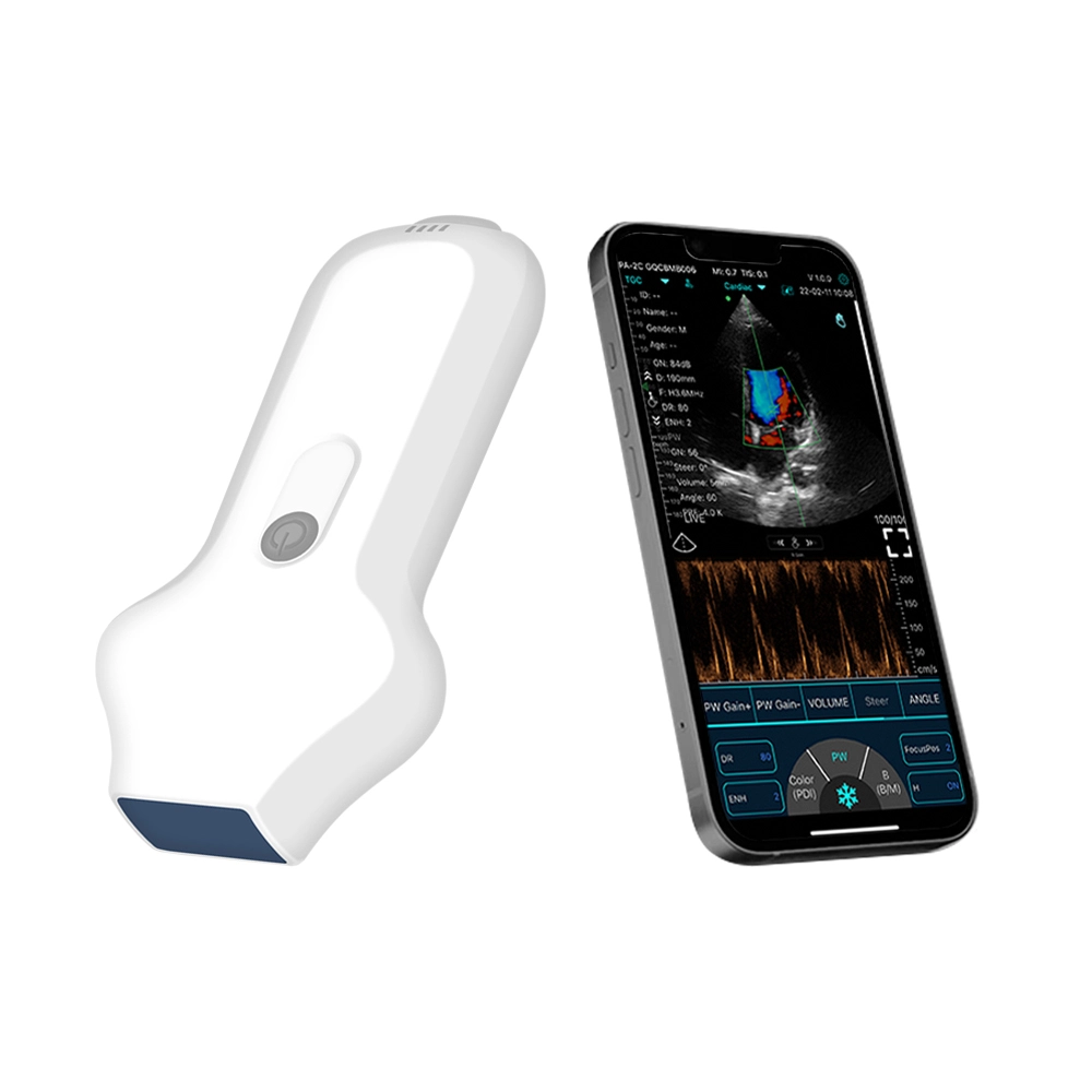 wireless c10cs ultrasound