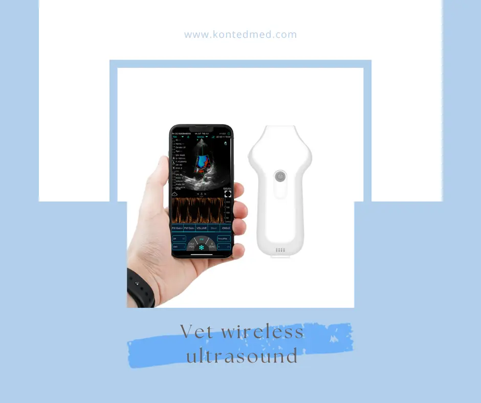 Features of C10UC cardiac wireless probe