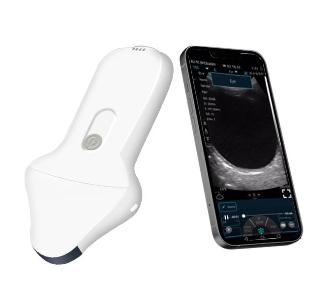 c10ue ophthalmic wireless ultrasound