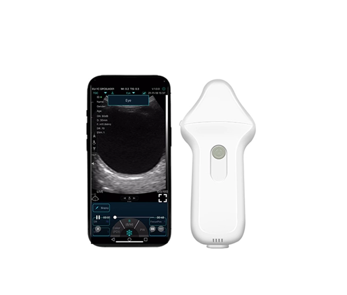 c10ue ophthalmic wireless ultrasound4