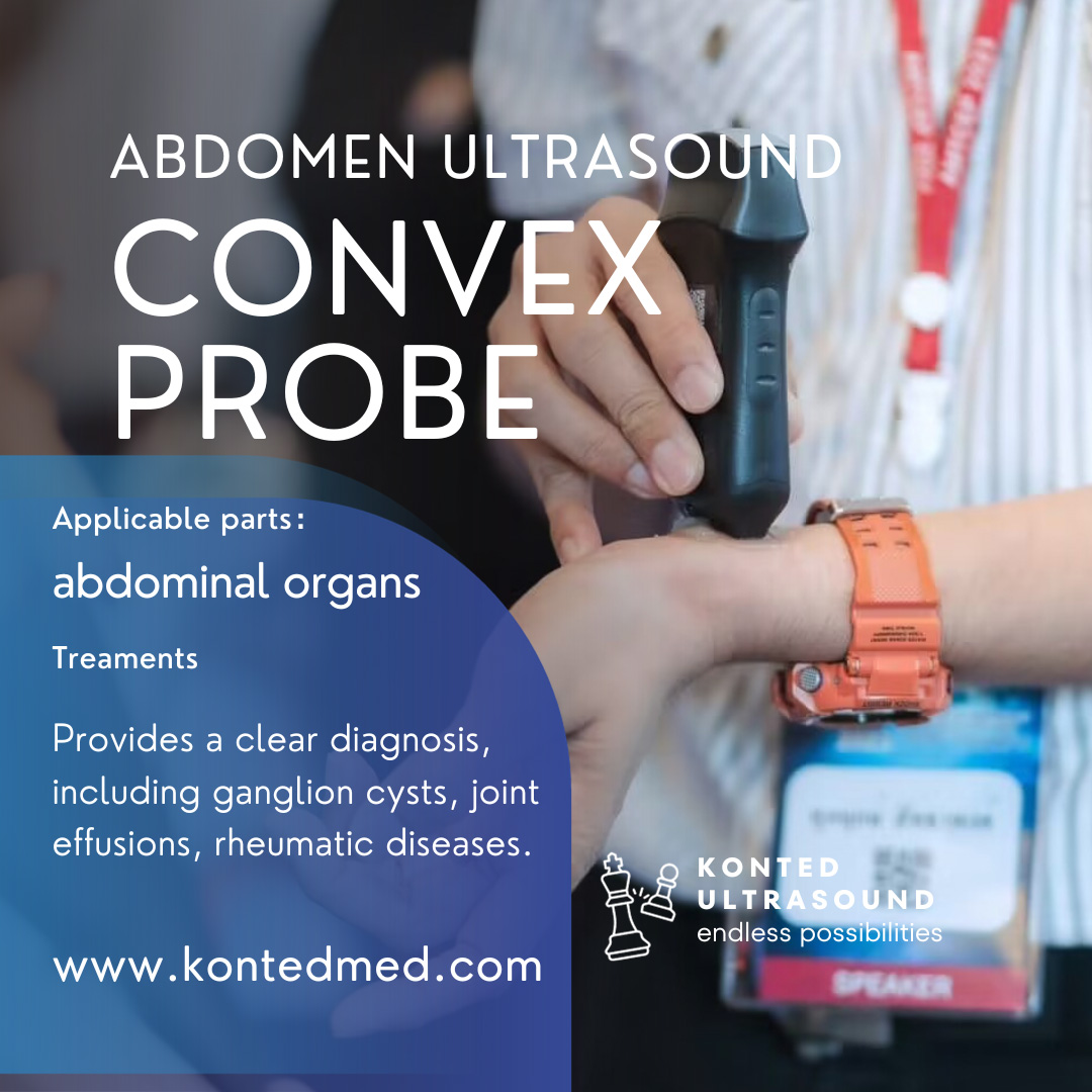 convex-ultrasound-probe.jpg