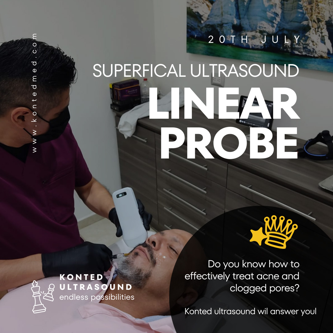 ultrasound-linear-probe.jpg