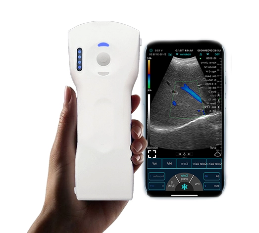 c10cx handheld ultrasound3