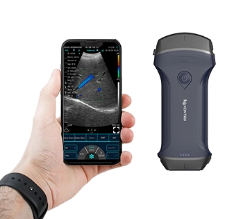 rl pro ultrasound device 3